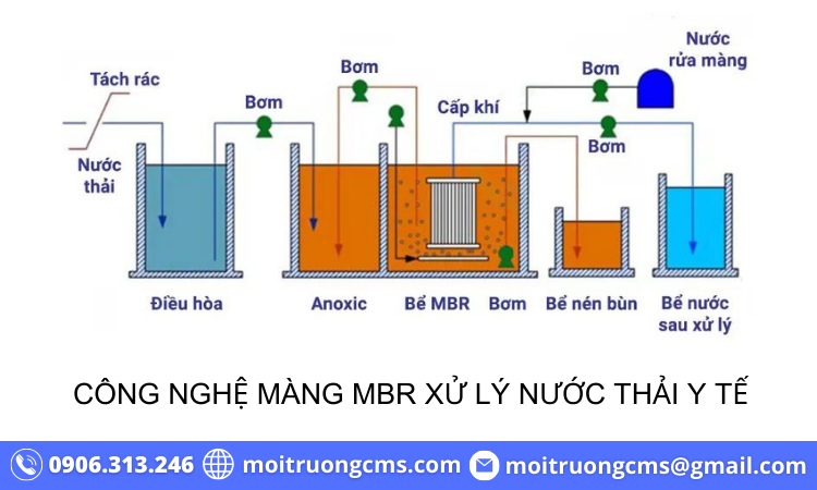 cong nghe mang mbr xu ly nuoc thai y te